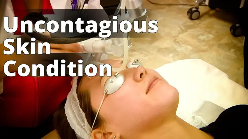 Co2-fractional-laser-ama-regenerative-medicine-skincare-1 - a woman getting a facial massage