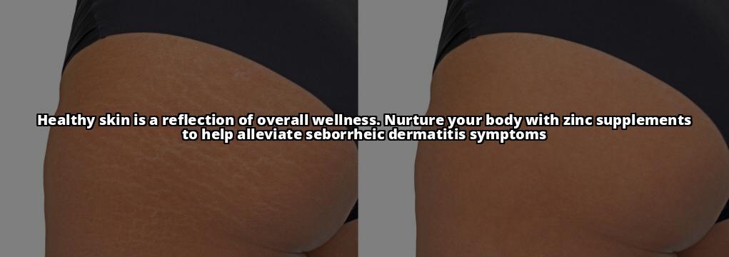 A Comprehensive Guide to Using Zinc Supplements for Seborrheic Dermatitis