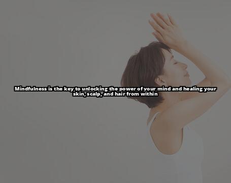 How Mindfulness Can Help with Seborrheic Dermatitis Treatment