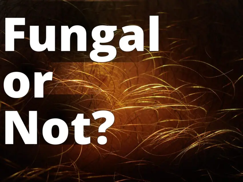 Human hair closeup-08960-nevit - a close up of a field of grass