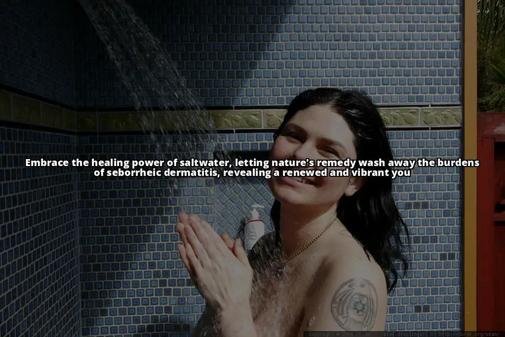 Saltwater Secrets: How to effectively treat Seborrheic Dermatitis on your skin, scalp, and hair