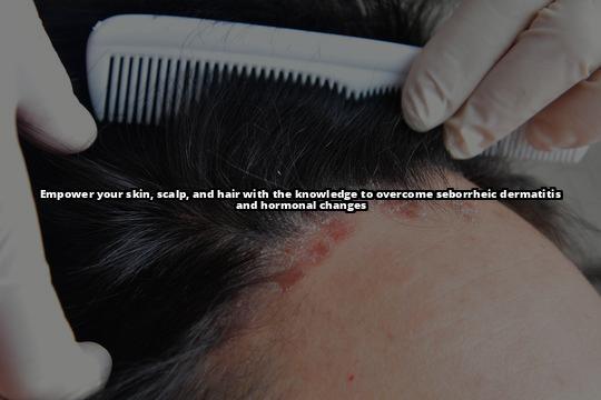 Seborrheic Dermatitis and Hormonal Changes: What You Need to Know
