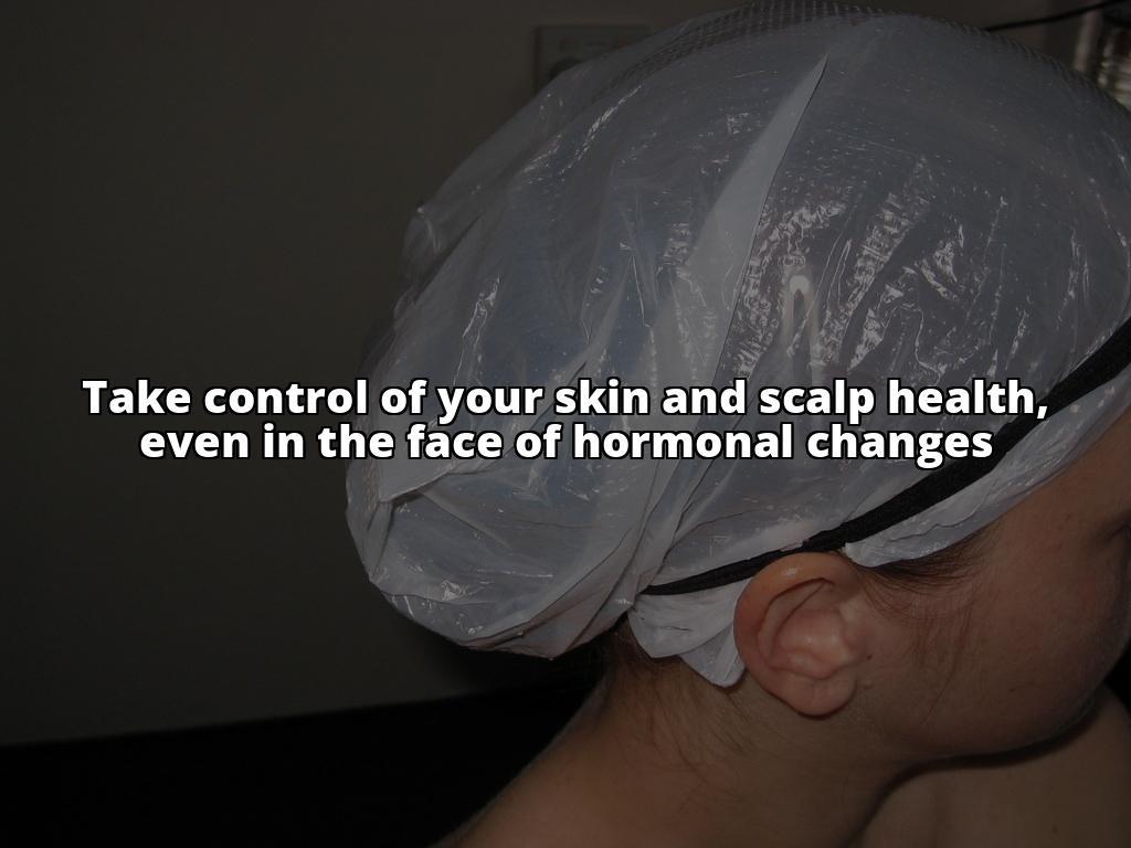 Seborrheic Dermatitis and Hormonal Changes: What You Need to Know