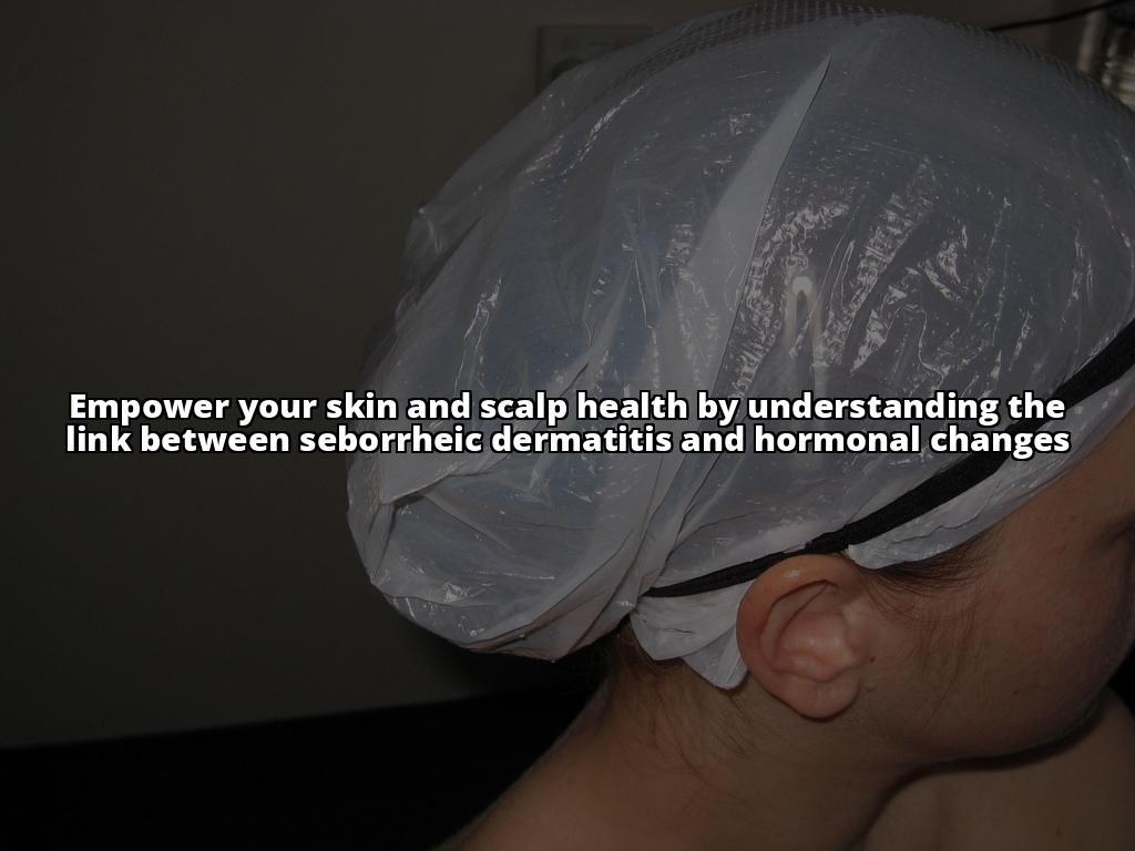Seborrheic Dermatitis and Hormonal Changes: What You Need to Know