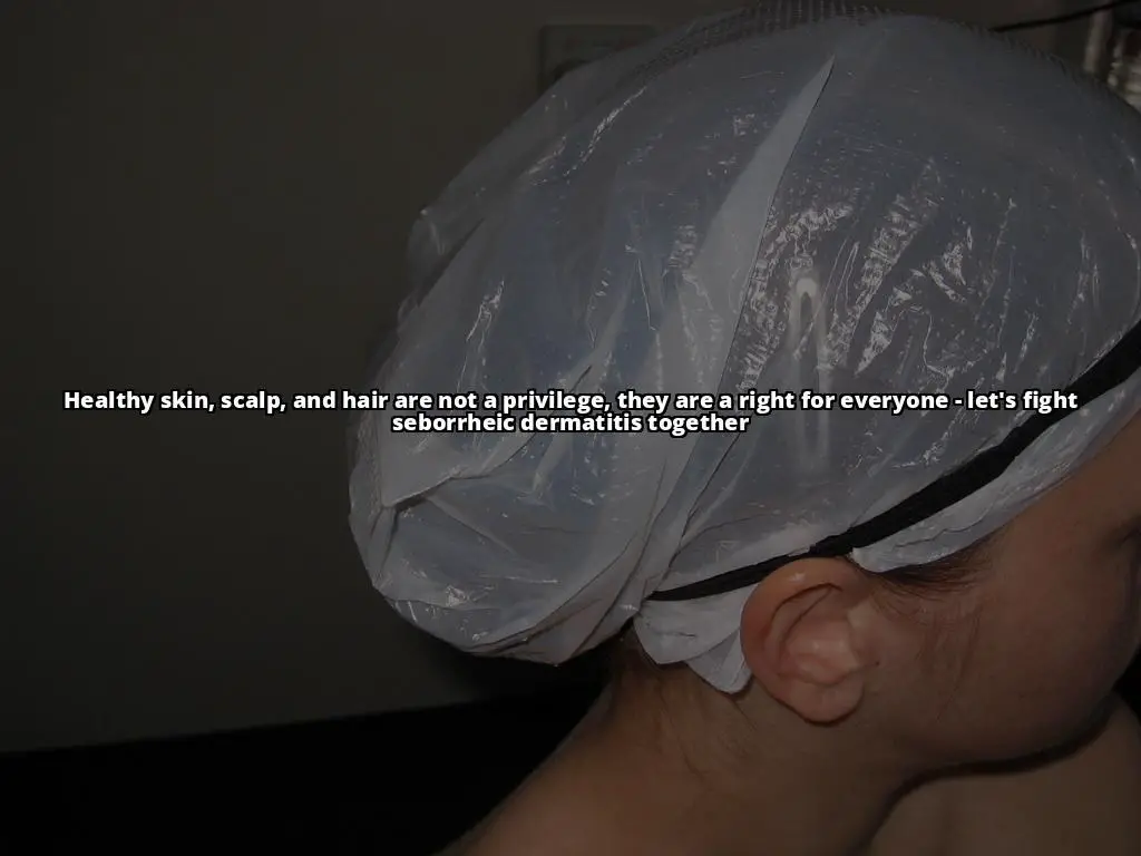 Seborrheic Dermatitis in Diverse Populations: Understanding the Condition and Treatment Options