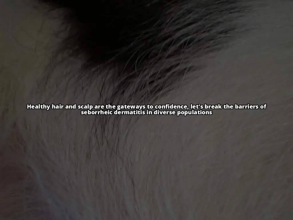 Seborrheic Dermatitis in Diverse Populations: Understanding the Condition and Treatment Options