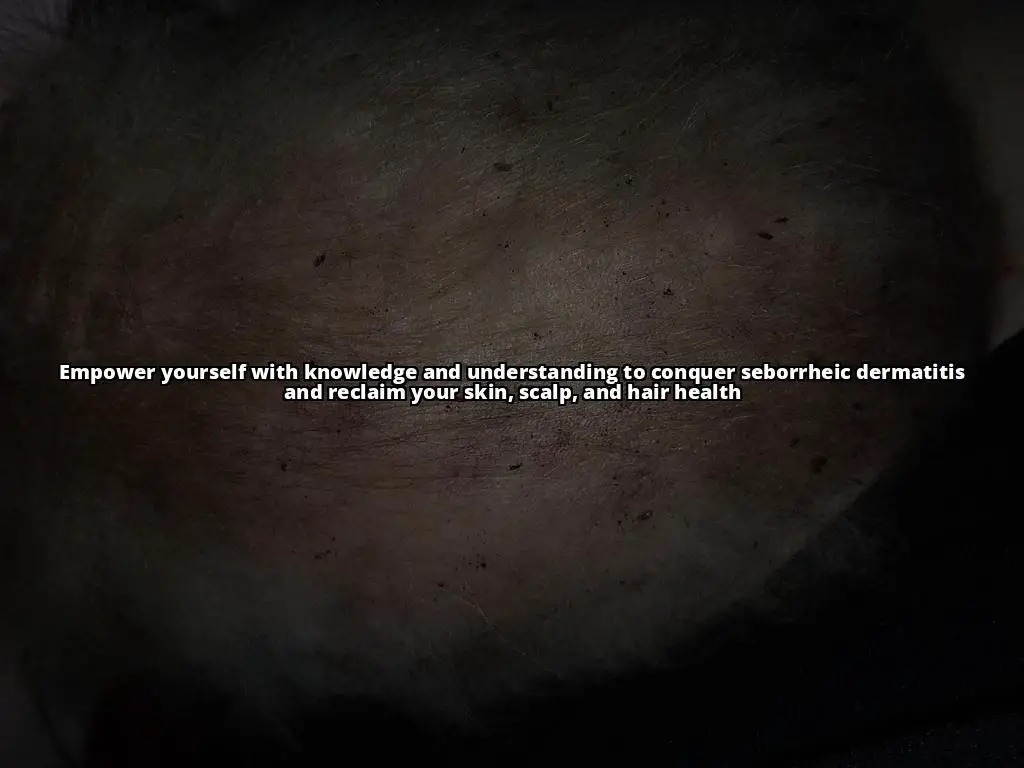 Sweating and Seborrheic Dermatitis: How to Manage Symptoms During Exercise