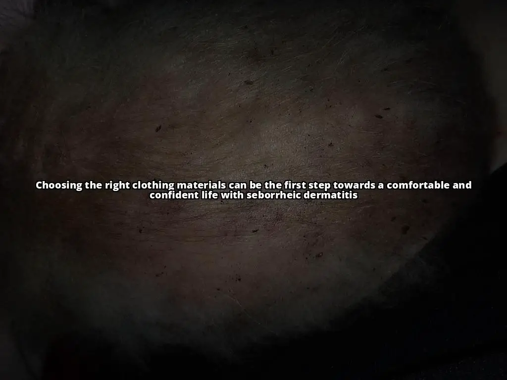 The Ultimate Guide to Choosing Clothes for Seborrheic Dermatitis