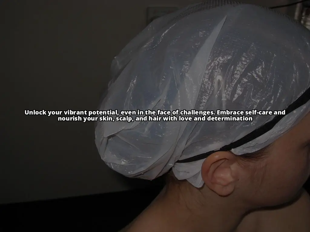 The Ultimate Guide to Managing Seborrheic Dermatitis and Hair Coloring