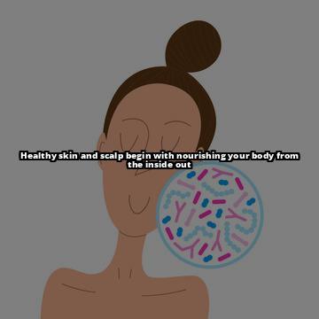 Thyroid Health and Seborrheic Dermatitis: The Surprising Connection