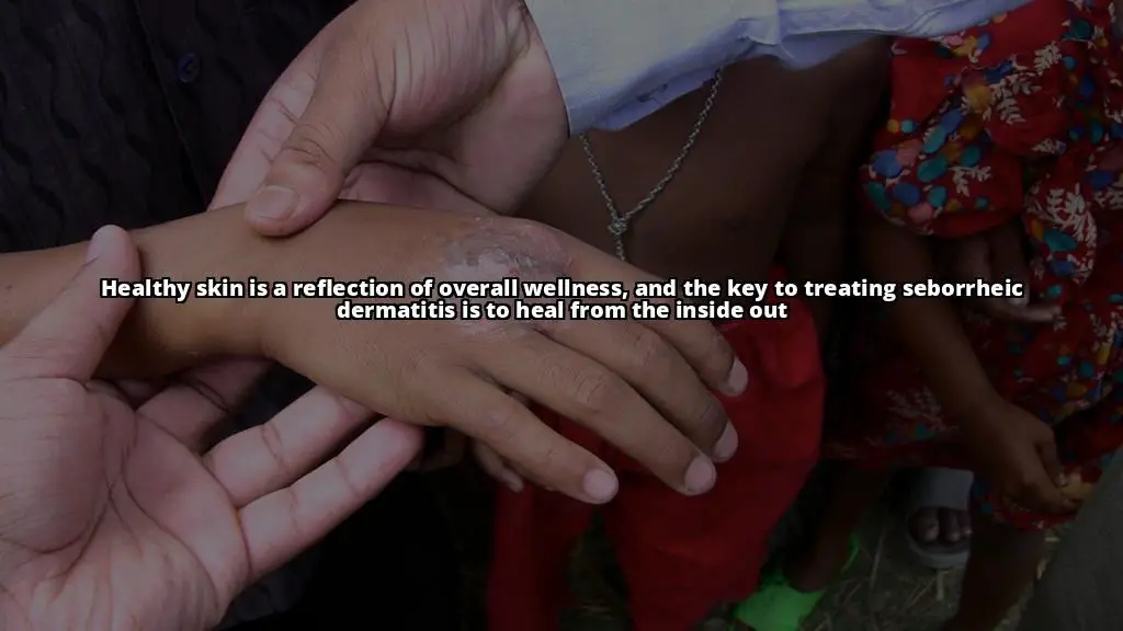 Seborrheic Dermatitis: The Differences in Symptoms and Treatment for Children and Adults Explained