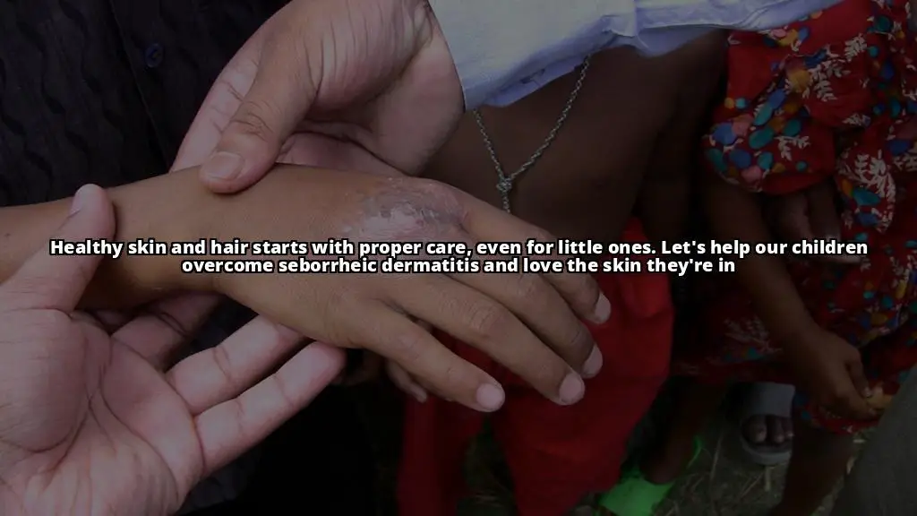 Seborrheic Dermatitis: The Differences in Symptoms and Treatment for Children and Adults Explained