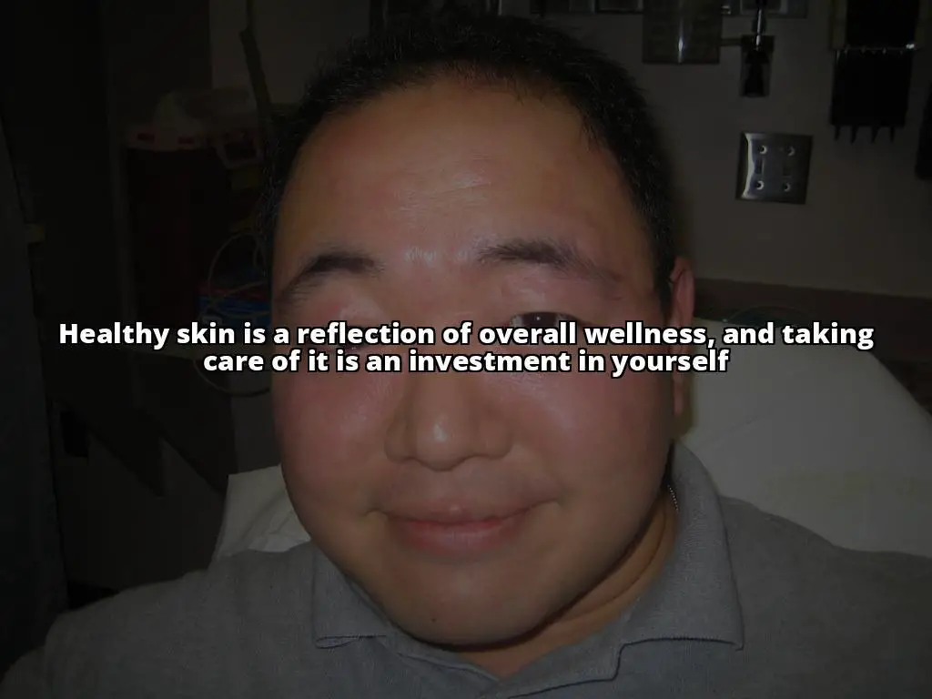 Seborrheic Dermatitis: The Differences in Symptoms and Treatment for Children and Adults Explained