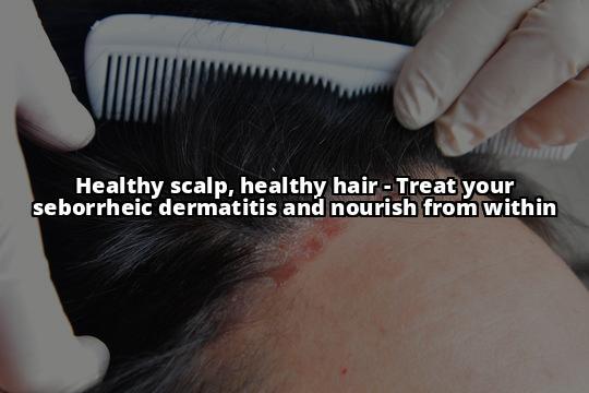 Seborrheic Dermatitis and Scalp Buildup: Your Complete Guide to a Healthy Scalp