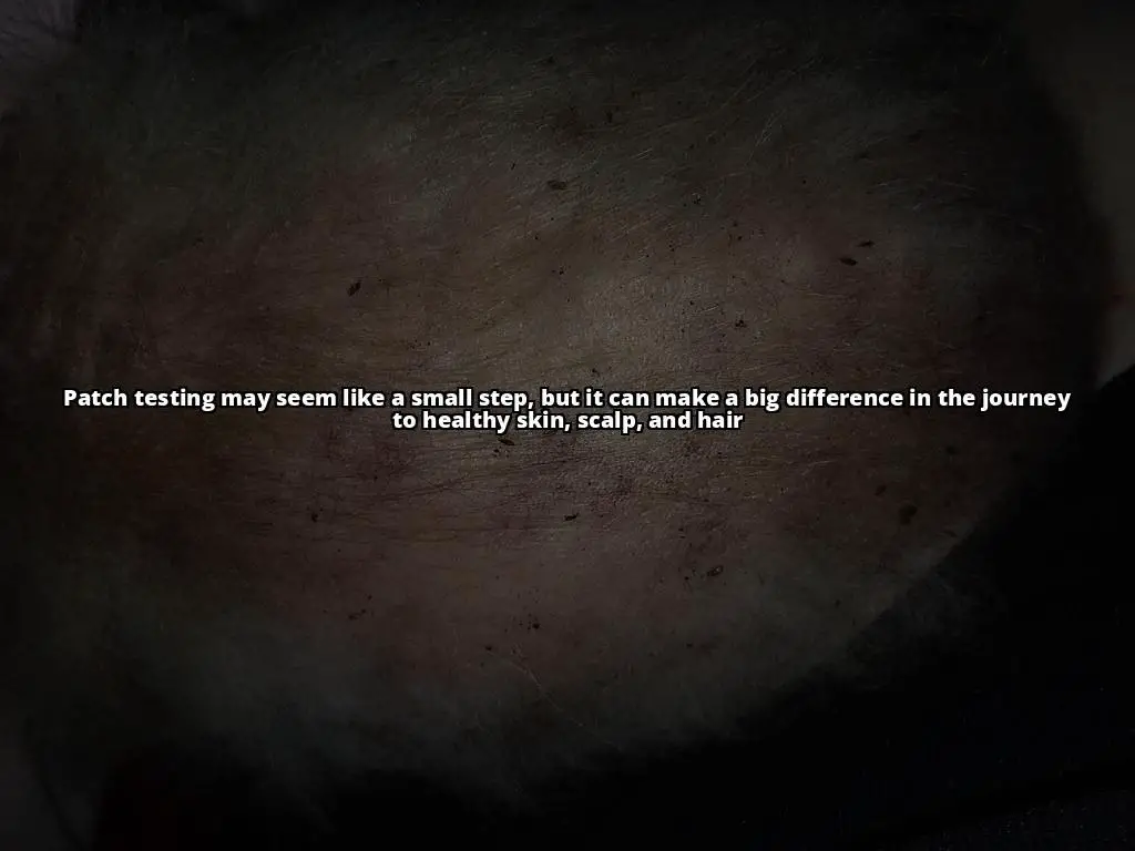 The Ultimate Guide to Patch Testing for Seborrheic Dermatitis Relief