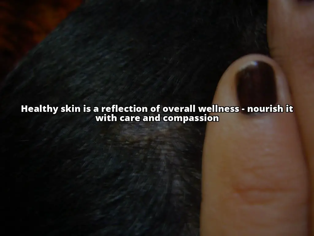 The Ultimate Guide to Treating Seborrheic Dermatitis with a Vegan Lifestyle