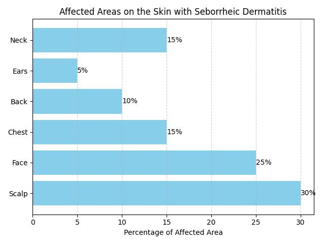 Overcoming Seborrheic Dermatitis at Work: Expert Guide