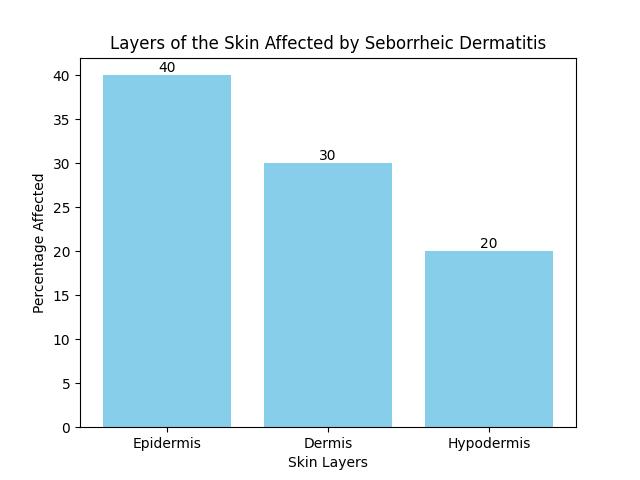 Exercise and Seborrheic Dermatitis: Dos and Don'ts for Success