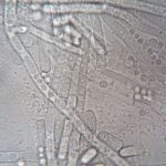 Seborrheic Dermatitis and Gut Health: The Microbiome Connection (2026) - Close-up image of fungal hyphae under microscope showcasing biological structures.