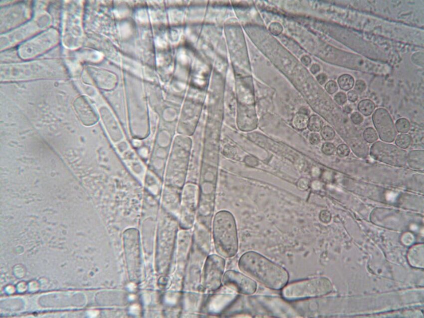 Seborrheic Dermatitis and Gut Health: The Microbiome Connection (2026) 7 Seborrheic Dermatitis and Gut Health: The Microbiome Connection (2026) - Close-up image of fungal hyphae under microscope showcasing biological structures.