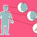 Symptoms - Cardboard appliques of person and round shaped illustrations with bacteria representing vulnerable areas of body during COVID 19 pandemic