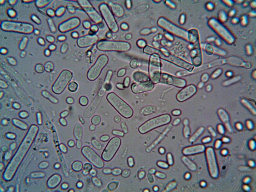 seborrheic-dermatitis-gut-health-microbiome-2026 - Close-up image of rod-shaped bacteria under a microscope, showcasing microscopic detail.